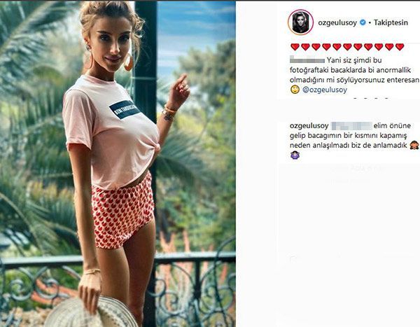 Özge Ulusoy, photoshop yaptığını söyleyen takipçisine yanıt verdi 7