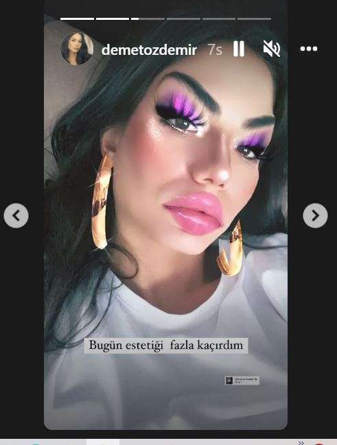 Demet Özdemir estetik iddiasını ortaya atanlara anladıkları dilden yanıt verdi! 7