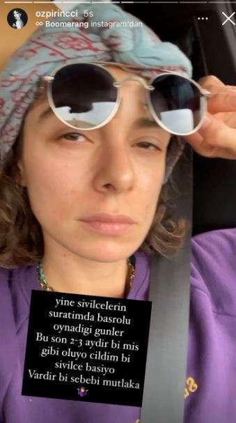 Dizilere dönmeye hazırlanan Özge Özpirinçci'nin yüzünü sivilce bastı! 7