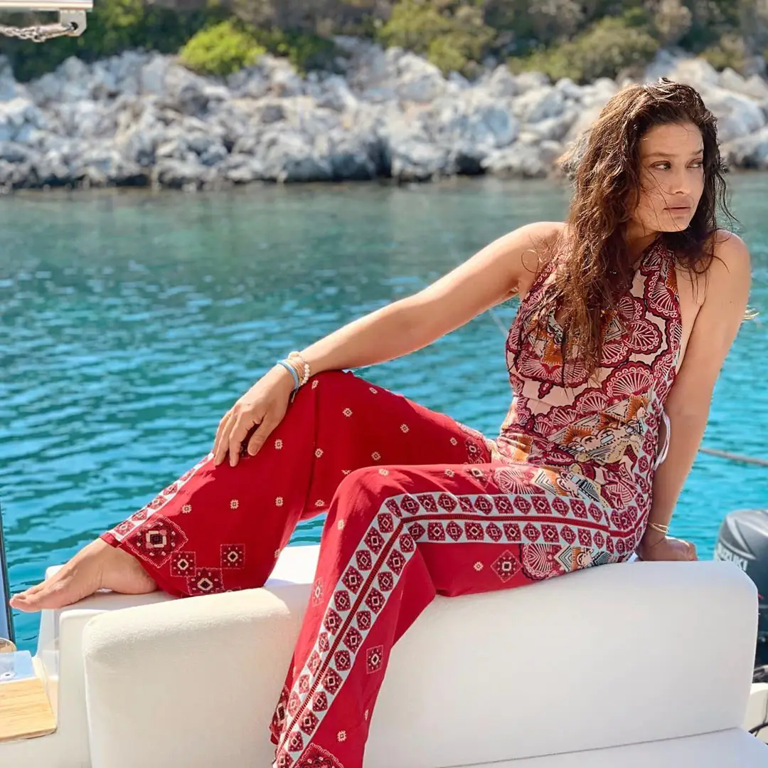 İlahi Nurgül Yeşilçay! Poz vereceğim diye kendini parçaladı! 11