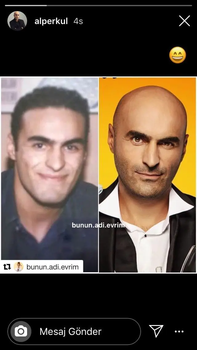 İlahi Alper Kul! Bu halini hatırlayan var mı acaba? Kendisi bile kahkahayı bastı! 7