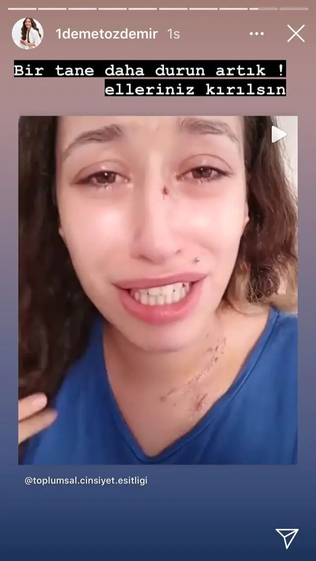 Demet Özdemir sosyal medyadan isyan etti: Elleriniz kırılsın! 8