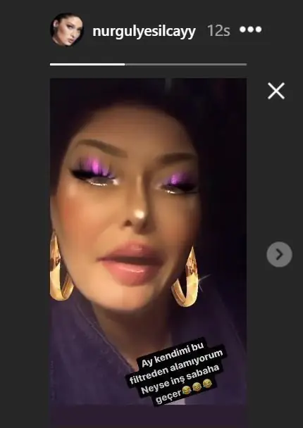 Sonu sürprizli! Nurgül Yeşilçay setten paylaştı, o filtreden bir türlü çakamadı! 7