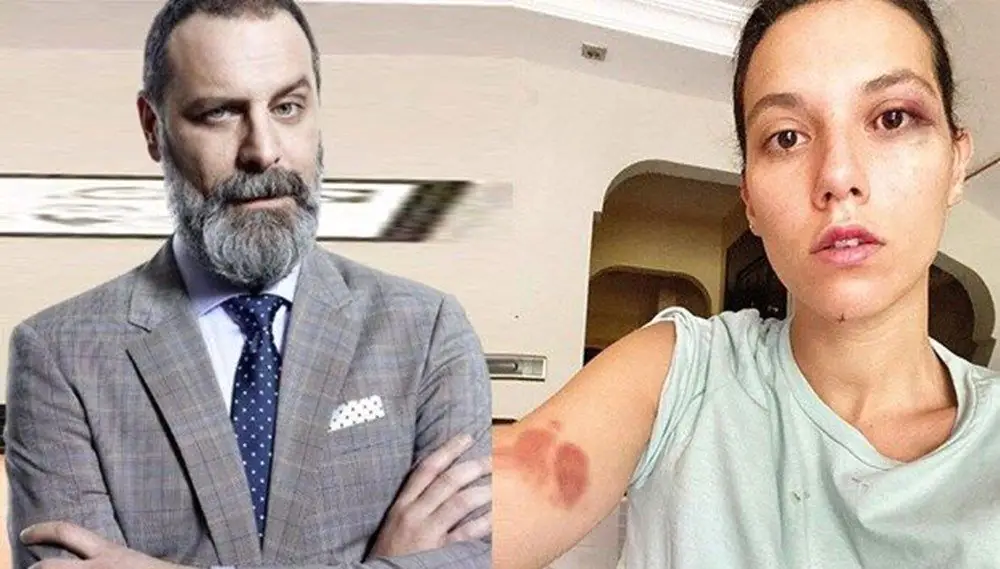 Yasak Elma'daki zor karardan sonra Babil dizisi için de zor bir karar aşaması! 9
