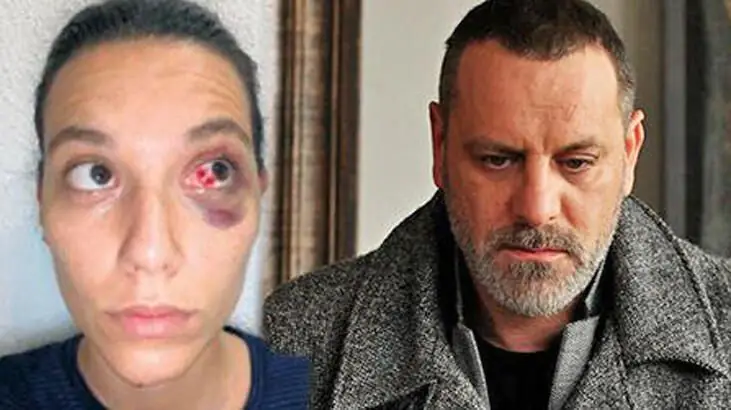 Halit Ergenç'e acımasızca vur, Şevval Sam'ı çaresiz bırak! Linç kültürü kurban arıyor! 11