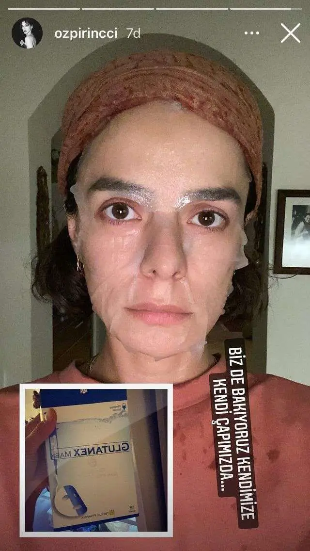 Özge Özpirinçci güzelleşmek için yaptı ama Alien filminden fırlamış gibi yüzü! 7