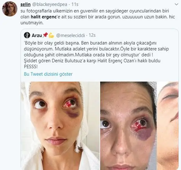 Halit Ergenç'in Ozan Güven'e desteği büyük hayal kırıklığı yarattı! 7